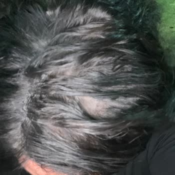 Bal Peruktan Aldığım Saç 5. Ayda Çöp Oldu.