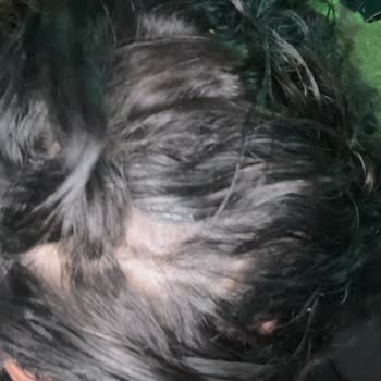 Bal Peruktan Aldığım Saç 5. Ayda Çöp Oldu.