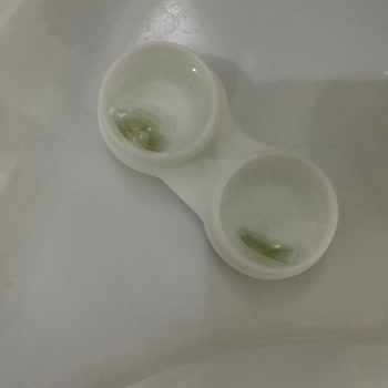 Labella Lens Yırtılıyor