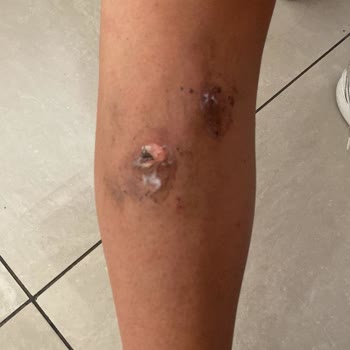 Victor Laris Beauty Lounge Victor Laris Lazer Felaketi