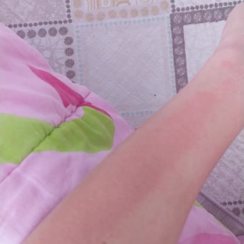 Kristalepilator.com.tr Kristal Epilatör Mağduruyum