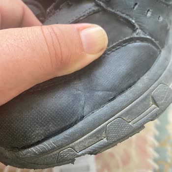 Skechers Ayakkabı Kısa Sürede Deforme Oldu!
