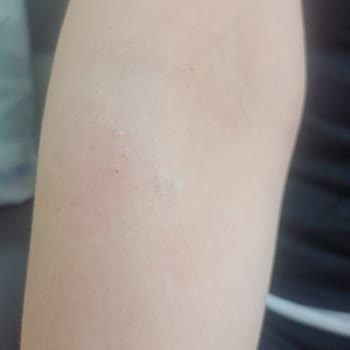 İstanbul Üniversitesi Tıp Fakültesi Tecrübesiz Ve Üslup Sorunu Olan Hemşireler