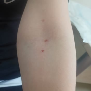 İstanbul Üniversitesi Tıp Fakültesi Tecrübesiz Ve Üslup Sorunu Olan Hemşireler