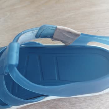 İgor Sandalet Kızımın Ayak Bileğinde Yara Yaptı