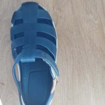 İgor Sandalet Kızımın Ayak Bileğinde Yara Yaptı