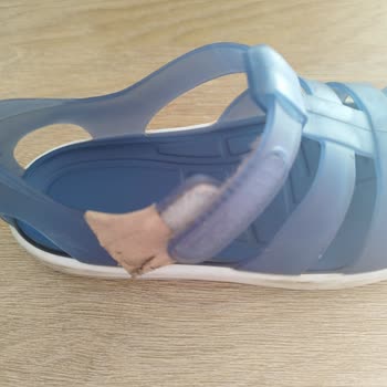 İgor Sandalet Kızımın Ayak Bileğinde Yara Yaptı