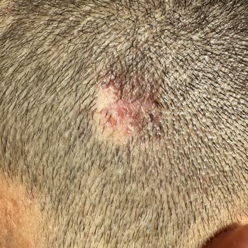 Maltepe Tıp Merkezi Sorumsuz Cerrahi Müdahale