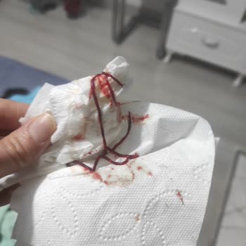 Bağcılar Şafak Hastanesi Estetik Mağduruyum