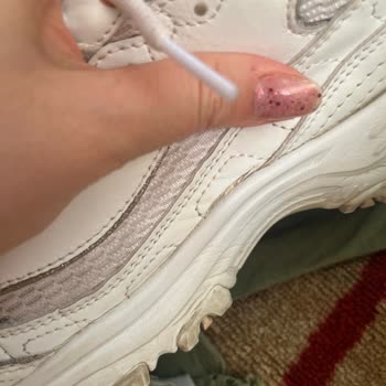 Skechers Ayakkabı Deforme Olması
