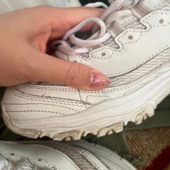 Skechers Ayakkabı Deforme Olması