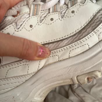 Skechers Ayakkabı Deforme Olması