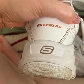 Skechers Ayakkabı Deforme Olması