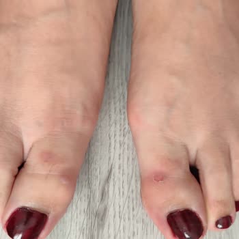 Deichmann Hatalı Ayakkabı Satıp Ürünü Kabul Etmiyor