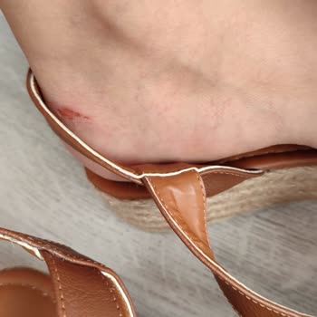 Deichmann Hatalı Ayakkabı Satıp Ürünü Kabul Etmiyor