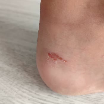 Deichmann Hatalı Ayakkabı Satıp Ürünü Kabul Etmiyor