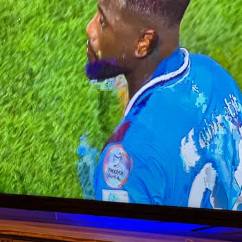 Tod TV Görüntü Kalitesi Çok Düşük