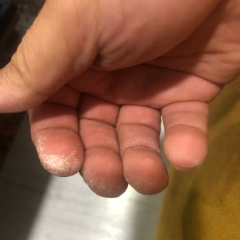 Vanish Kosla Elim Yandı Hala Da Yanıyor