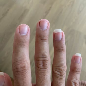 Coiffeur Kübra'da Manikür Pedikürden Sonra İltihaplanma