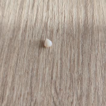 Orvital Kasap Köftenin İçinden Çıkan Kemik