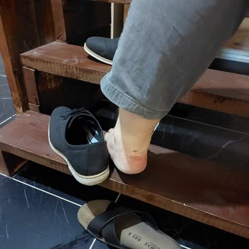 FLO Ayakkabı Aldığım Ayakkabıların Her İki Tabanımın Derisini Kaldırmış Olması