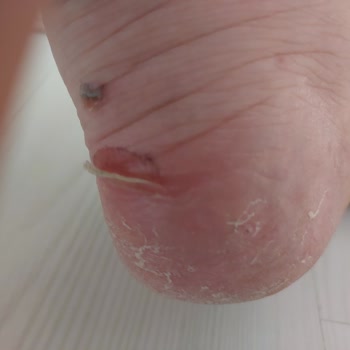 FLO Ayakkabı Aldığım Ayakkabıların Her İki Tabanımın Derisini Kaldırmış Olması