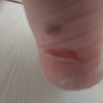 FLO Ayakkabı Aldığım Ayakkabıların Her İki Tabanımın Derisini Kaldırmış Olması