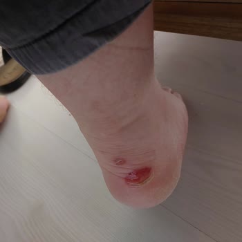 FLO Ayakkabı Aldığım Ayakkabıların Her İki Tabanımın Derisini Kaldırmış Olması