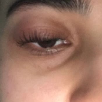 New Life Güzellik Kirpik Liftingi Sonrası Gözde Şişlik!