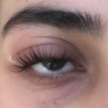 New Life Güzellik Kirpik Liftingi Sonrası Gözde Şişlik!