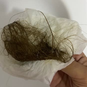 Loreal Excellence 7.1 Boyası Aldım, Saçlarım İnanılmaz Döküldü