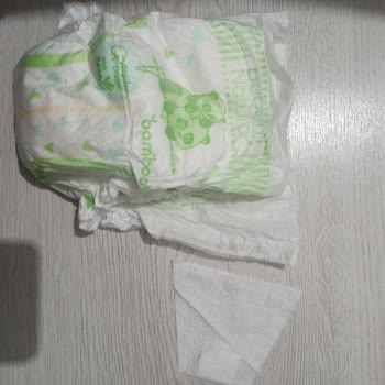 Bebem Natural Bezinin Yan Bez Cırtların Kopması