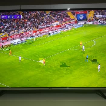 Tod TV Yayın Kalitesi Sorunu