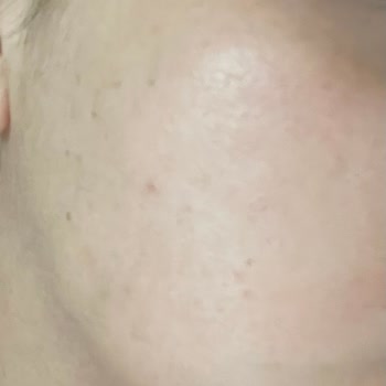 Yves Rocher Sebo Vegetal Jel Krem Yüzümü Mahvetti