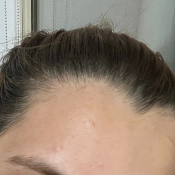 Yves Rocher Sebo Vegetal Jel Krem Yüzümü Mahvetti