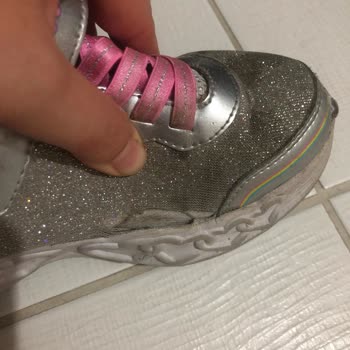 Skechers Tan Sezonunda Aldığım Ayakkabı 4 Ayda Yanlarından Açıldı