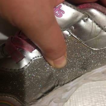Skechers Tan Sezonunda Aldığım Ayakkabı 4 Ayda Yanlarından Açıldı
