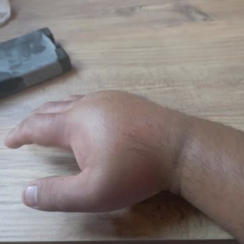 Özel Gazi Hastanesi (İzmir) Damar Yolunu Bulduk Deyip Bulamadılar