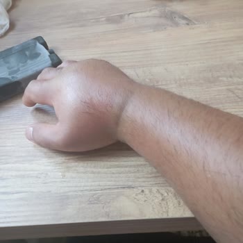 Özel Gazi Hastanesi (İzmir) Damar Yolunu Bulduk Deyip Bulamadılar