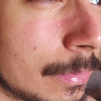 Yves Rocher Mağazasından Aldığım Cilt Bakım Ürünleri İle İlgili Şikayetim