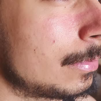 Yves Rocher Mağazasından Aldığım Cilt Bakım Ürünleri İle İlgili Şikayetim