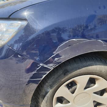 Dalya Resort Hotel Pişmanlığı