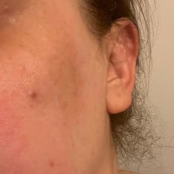 Aris Çukurambar Vip Memnuniyetsizliği