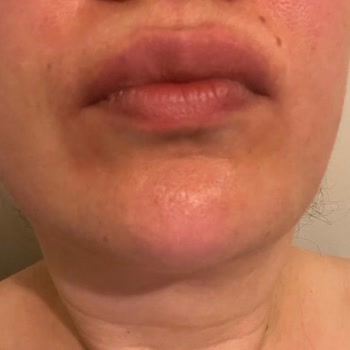 Aris Çukurambar Vip Memnuniyetsizliği