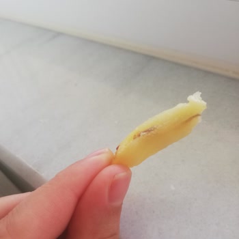 Superfresh Patates Kızartması İçinden Yabancı Cisim Çıktı