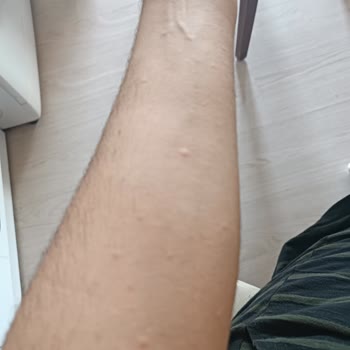 Le Petit Marseillais Duş Jeli Alerji Yaptı