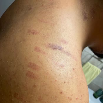 Bionep Güzellik Merkezi Giden Herkesi Yaktılar İsi Bilmiyorlar Hijyen 0 Ispartakule Şube