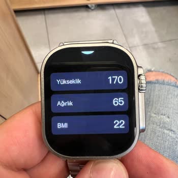 Bi Elma Teknoloji Satış Sonrası İlgisizlik