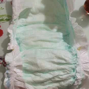 Deforme Bebek Bezi Molfix