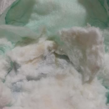 Deforme Bebek Bezi Molfix